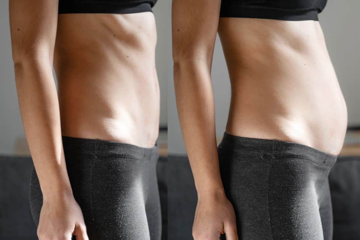 How long does diastasis recti take to improve Wincanton?