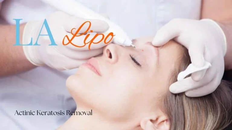 Woman receiving Actinic Keratosis Removal Treatment Wincanton