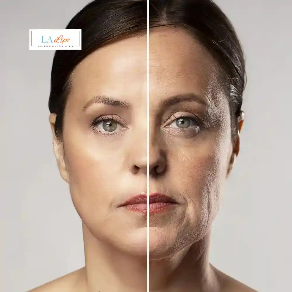 How Can You Tell If Non-Surgical Skin Tightening Is Right for You Wincanton?