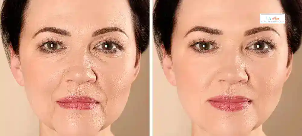 Why Aren’t My Skincare Products Making My Sagging Skin Look Firmer Wincanton?